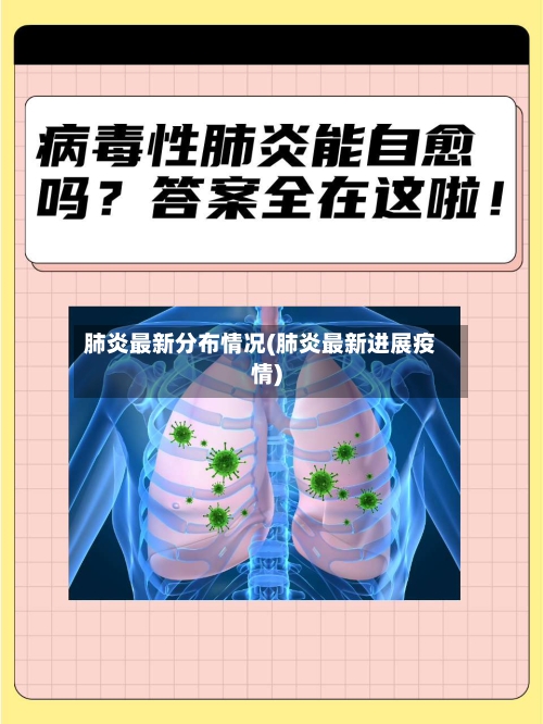 肺炎最新分布情况(肺炎最新进展疫情)-第2张图片