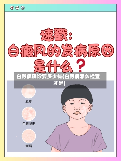白殿疯确诊要多少钱(白殿病怎么检查才是)-第3张图片
