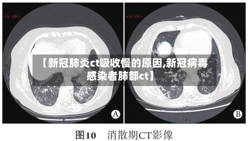 【新冠肺炎ct吸收慢的原因,新冠病毒感染者肺部ct】-第2张图片